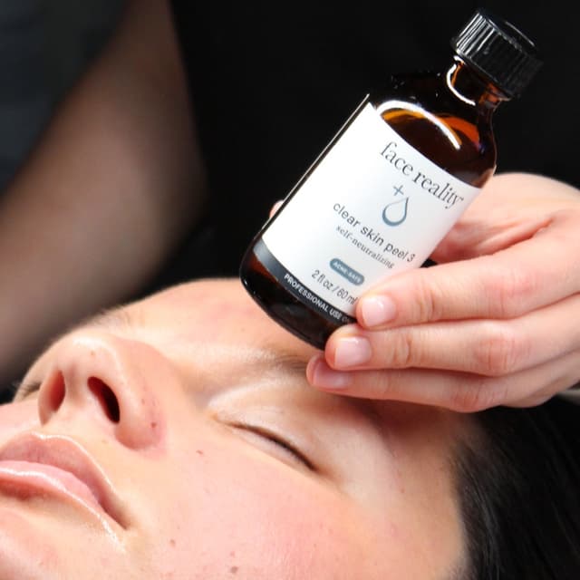 Chemical Peel Series of 8 at Stone Skin Studio in Palm Harbor, FL